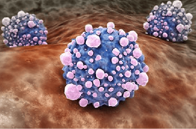 口腔癌の癌細胞イメージ