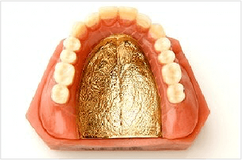 金属床義歯（ゴールド）イメージ