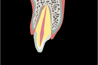 歯の変色や歯肉の腫れ